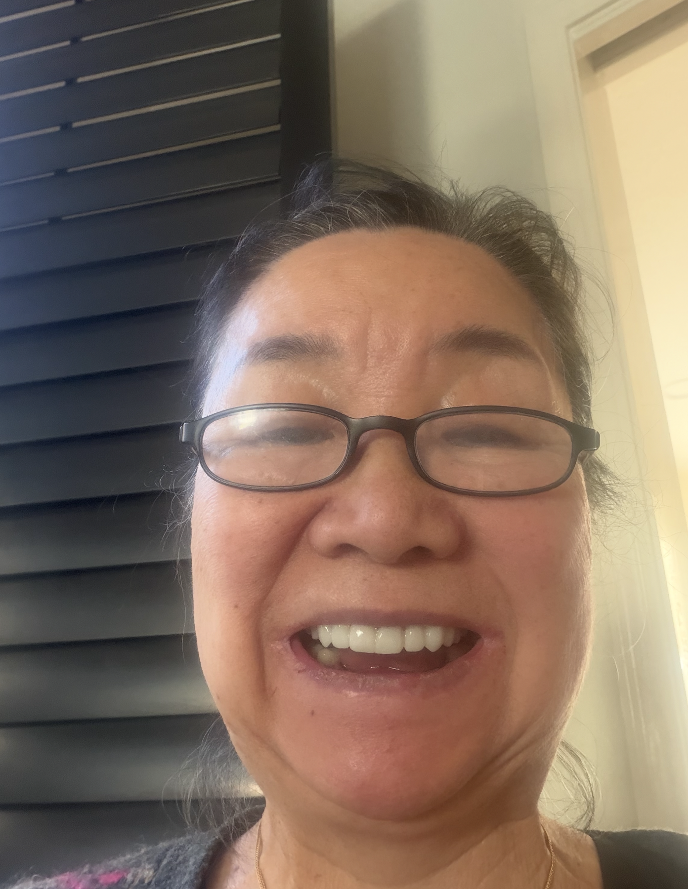 Marilyn smiling with her new upper crowns after treatment in Los Algodones.