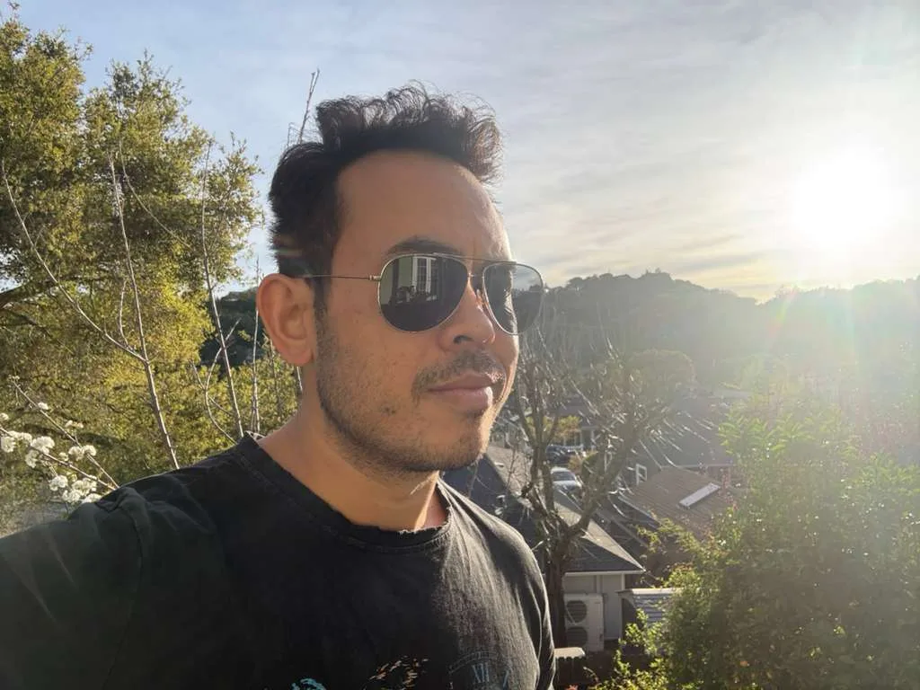 Tony G., who traveled to Bangkok for fat freezing