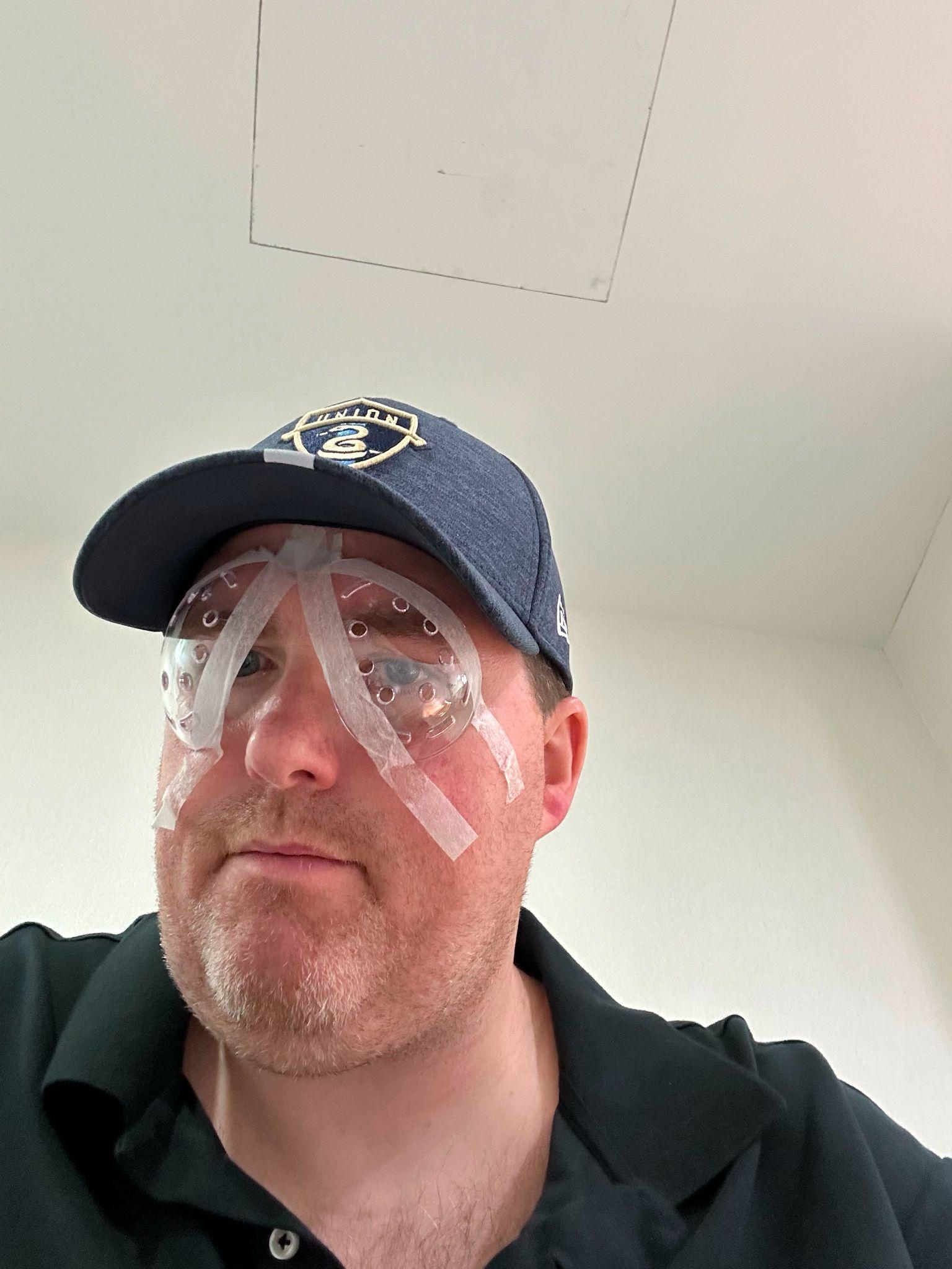 Brian wearing a Philadelphia Union cap and clear plastic eye shields taped over both eyes right after LASIK surgery.