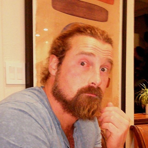 George S., Hair Transplant patient